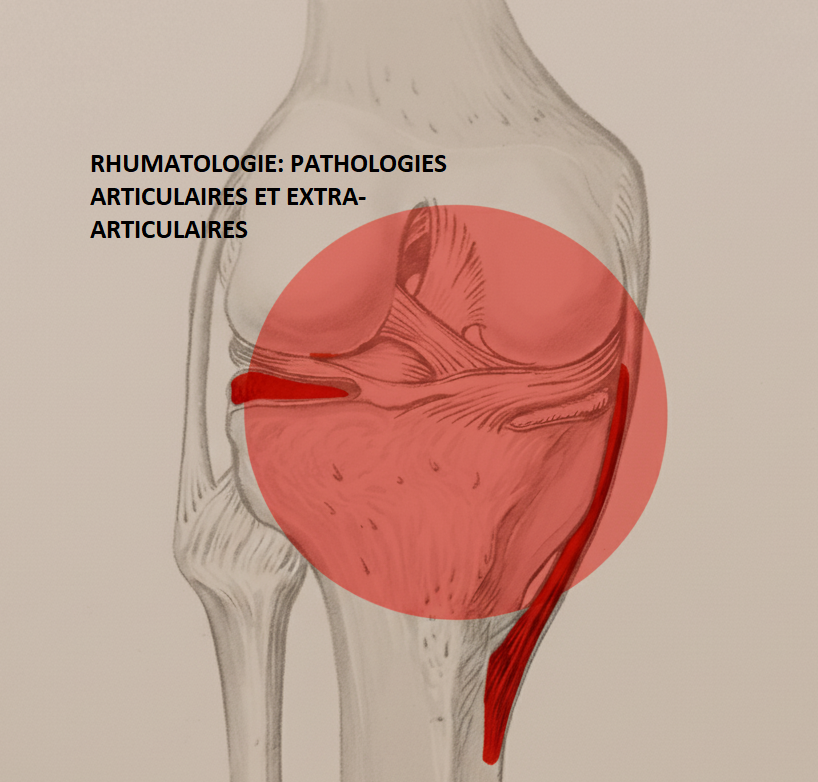 kinésithérapie rhumatologie
