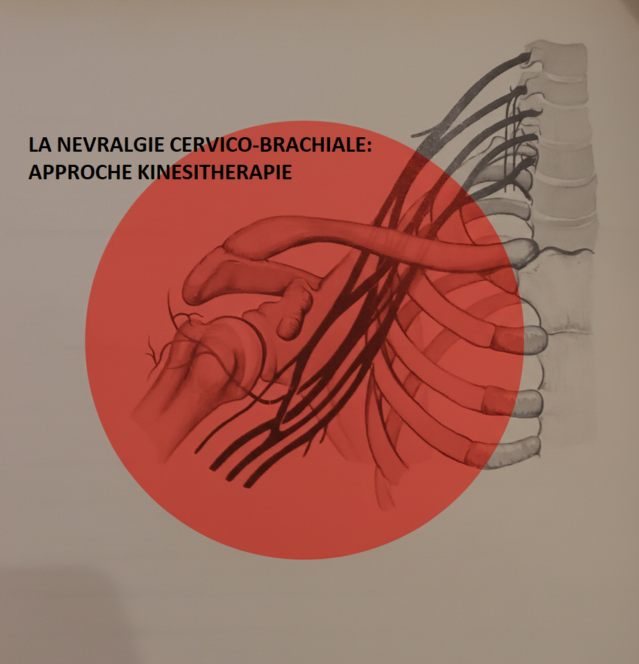 nevralgie cervico-brachiale kinésithérapie